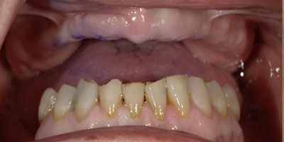 smile-before-54